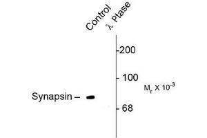 Image no. 1 for anti-Synapsin I (SYN1) (pSer549) antibody (ABIN372720)