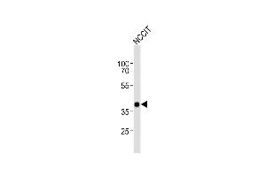 Anti-DA4 Antibody (Center) at 1:1000 dilution + NCCIT whole cell lysates Lysates/proteins at 20 μg per lane.