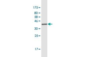 Western Blot detection against Immunogen (37. (FUBP3 antibody  (AA 152-261))