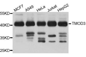 Western Blotting (WB) image for anti-Tropomodulin 3 (TMOD3) (AA 1-352) antibody (ABIN6220733) (TMOD3 antibody  (AA 1-352))