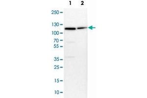 Western Blot analysis of Lane 1: NIH-3T3 cell lysate (mouse embryonic fibroblast cells) and Lane 2: NBT-II cell lysate (Wistar rat bladder tumor cells) with MCM6 polyclonal antibody .