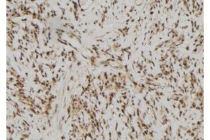 ABIN6279761 at 1/100 staining Human gastric tissue by IHC-P. (RFPL2 antibody)