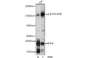 Western blot analysis of extracts of Raji cells, using Phospho-B-Raf-S445 pAb (ABIN3019431, ABIN3019432, ABIN3019433, ABIN1681422 and ABIN6225367) at 1:2000 dilution or BRAF antibody (ABIN6131244, ABIN6137637, ABIN6137639 and ABIN6213593). (BRAF antibody  (pSer445))