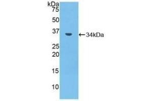 Detection of Recombinant MMP7, Mouse using Polyclonal Antibody to Matrix Metalloproteinase 7 (MMP7) (MMP7 antibody  (AA 1-264))