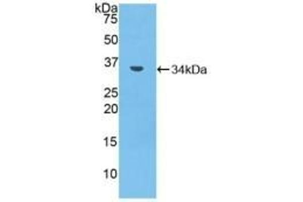 MMP7 抗体  (AA 1-264)