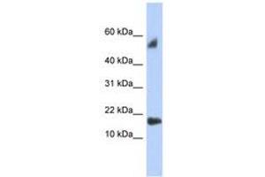Image no. 1 for anti-Testis Expressed 19 (TEX19) (C-Term) antibody (ABIN6743950) (TEX19 antibody  (C-Term))
