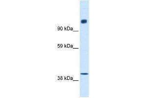 NCOR1 antibody used at 0. (NCOR1 antibody  (N-Term))
