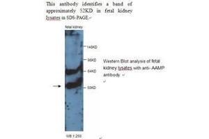 Image no. 1 for anti-Angio-Associated, Migratory Cell Protein (AAMP) antibody (ABIN790850)
