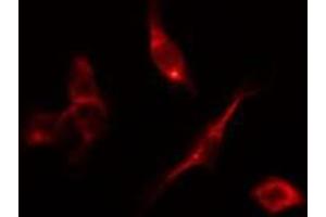ABIN6278199 staining HepG2 by IF/ICC. (DAPK2 antibody  (C-Term))