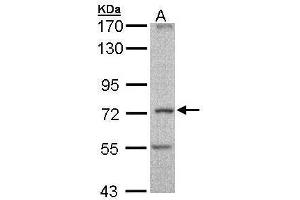 WB Image Sample (30 ug of whole cell lysate) A: Molt-4 , 7. (DNAI2 antibody  (C-Term))
