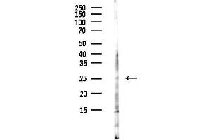 anti-ARPIN antibody