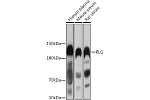 Western blot analysis of extracts of various cell lines, using PLG antibody (ABIN1682202, ABIN3017690, ABIN3017692 and ABIN6220212) at 1:1000 dilution. (PLG antibody  (AA 20-300))