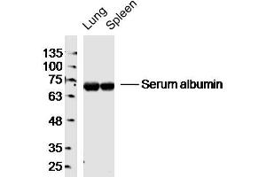 Lane 1: Mouse Lung lysates Lane 2: Mouse Spleen lysates probed with Serum albumin Polyclonal Antibody, Unconjugated  at 1:300 dilution and 4˚C overnight incubation. (Albumin antibody)