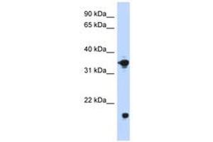 Image no. 1 for anti-Glycerol-3-Phosphate Dehydrogenase 1 (Soluble) (GPD1) (AA 251-300) antibody (ABIN6740752) (GPD1 antibody  (AA 251-300))