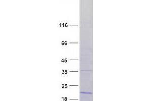 RPL36 Protein (Transcript Variant 2) (Myc-DYKDDDDK Tag)