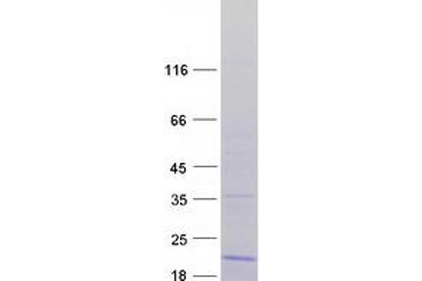 RPL36 Protein (Transcript Variant 2) (Myc-DYKDDDDK Tag)