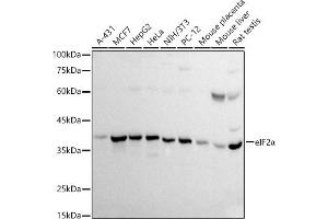 Western blot analysis of extracts of various cell lines, using eIF2α antibody (ABIN3021126, ABIN3021127, ABIN5663762 and ABIN6213983) at 1:500 dilution. (EIF2S1 antibody  (AA 1-260))