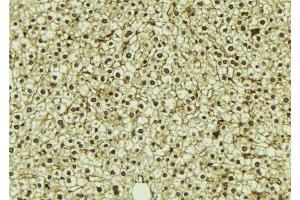 ABIN6273311 at 1/100 staining Mouse liver tissue by IHC-P. (ROGDI antibody)