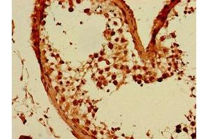 Immunohistochemistry of paraffin-embedded human testis tissue using ABIN7153725 at dilution of 1:100 (GFRA3 antibody  (AA 32-236))