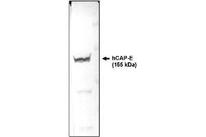 Western Blotting (WB) image for anti-Structural Maintenance of Chromosomes 2 (SMC2) (AA 523-768) antibody (ABIN264446) (SMC2 antibody  (AA 523-768))