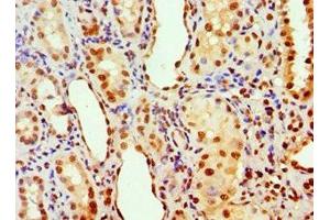 Immunohistochemistry of paraffin-embedded human kidney tissue using ABIN7143011 at dilution of 1:100 (PHAP1 antibody  (AA 1-170))