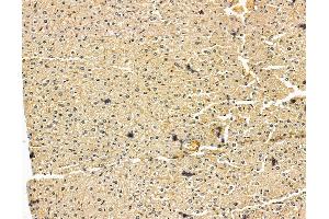 ABIN7096031 and ABIN7100093 at 1/100 staining mouse liver tissue by IHC-P. (DENND1A antibody)