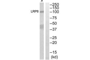Western blot analysis of extracts from Jurkat cells, using LRP8 antibody. (LRP8 antibody  (Internal Region))