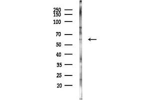 anti-DnaJ (Hsp40) Homolog, Subfamily C, Member 3 (DNAJC3) (C-Term) antibody