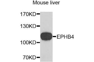 Western blot analysis of extracts of mouse liver, using EPHB4 antibody. (EPH Receptor B4 antibody)