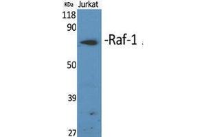 Western Blotting (WB) image for anti-V-Raf-1 Murine Leukemia Viral Oncogene Homolog 1 (RAF1) (Thr566) antibody (ABIN3186669) (RAF1 antibody  (Thr566))