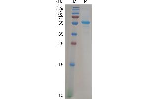 Human A Protein, His Tag on SDS-PAGE under reducing (R) conditions.