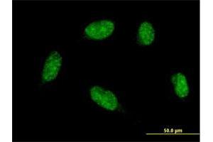 Immunofluorescence of monoclonal antibody to ATOH1 on HeLa cell. (ATOH1 antibody  (AA 266-354))