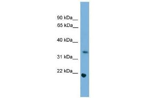 Western Blot showing Sohlh1 antibody used at a concentration of 1-2 ug/ml to detect its target protein. (SOHLH1 antibody  (Middle Region))