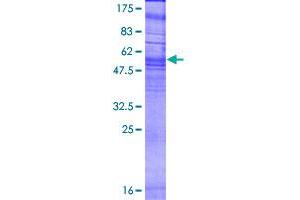 Image no. 1 for Oxoglutarate (Alpha-Ketoglutarate) Receptor 1 (OXGR1) (AA 1-337) protein (GST tag) (ABIN1313790) (OXGR1 Protein (AA 1-337) (GST tag))