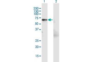 Western Blot analysis of LCP1 expression in transfected 293T cell line by LCP1 MaxPab polyclonal antibody. (LCP1 antibody  (AA 1-627))