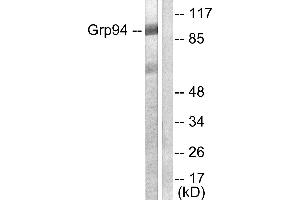 Western blot analysis of extracts from SKOV3 cells, using GRP94 antibody (#C0218). (GRP94 antibody)