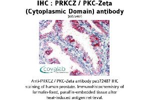 Image no. 1 for anti-Protein Kinase C, zeta (PRKCZ) (1st Cytoplasmic Domain) antibody (ABIN1738343) (PKC zeta antibody  (1st Cytoplasmic Domain))