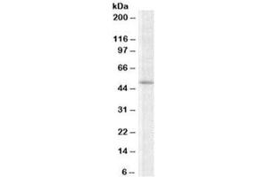 Western blot testing of K562 lysate with TRIP6 antibody at 2ug/ml. (TRIP6 antibody)