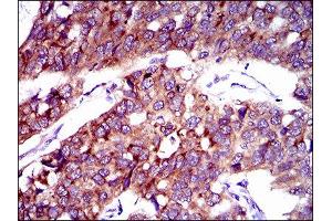 Immunohistochemistry (IHC) image for anti-Solute Carrier Family 27 (Fatty Acid Transporter), Member 2 (SLC27A2) (AA 346-405) antibody (ABIN1845739) (SLC27A2 antibody  (AA 346-405))