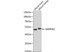 Western blot analysis of extracts of various cell lines using SERPINE2 Polyclonal Antibody at dilution of 1:1000. (SERPINE2 antibody)