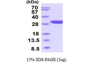 SDS-PAGE (SDS) image for Erythropoietin Receptor (EPOR) (AA 25-250) (Active) protein (His tag) (ABIN6387943) (EPOR Protein (AA 25-250) (His tag))