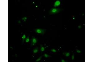 Detection of IL17RC in Human HepG2 Cells using Polyclonal Antibody to Interleukin 17 Receptor C (IL17RC) (IL17RC antibody  (AA 257-477))