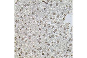 Immunohistochemistry of paraffin-embedded mouse liver using ZNF408 antibody (ABIN5974874) at dilution of 1/100 (40x lens). (ZNF408 antibody)