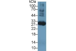 Detection of TF in Rat Blood Cells lysate using Polyclonal Antibody to Tissue Factor (TF) (Tissue factor antibody  (AA 30-252))