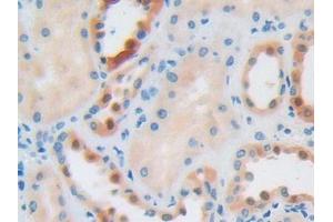 DAB staining on IHC-P; Samples: Human Kidney Tissue (IGF2R antibody  (AA 2167-2442))