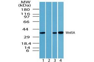 Wnt5A Western Blot.