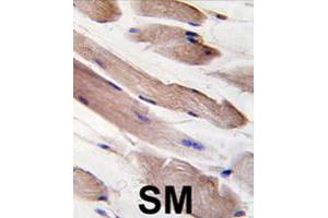 Formalin-fixed and paraffin-embedded human skeletal muscle tissue reacted with PIK3R1 polyclonal antibody  , which was peroxidase-conjugated to the secondary antibody, followed by DAB staining. (PIK3R1 antibody  (Tyr580))