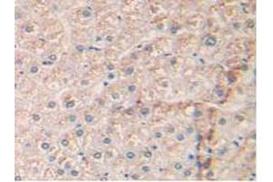 IHC-P analysis of Human Liver Tissue, with DAB staining. (EGFR antibody  (AA 713-984))