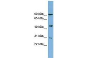 Image no. 1 for anti-Nitrogen Permease Regulator-Like 2 (S. Cerevisiae) (NPRL2) (AA 287-336) antibody (ABIN6742041)