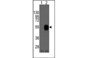 Western blot analysis of CD14(arrow) using rabbit polyclonal CD14 Antibody (CD14 antibody  (N-Term))